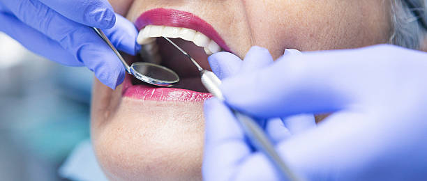 Best Emergency Wisdom Tooth Extraction in Blue Grass, IA